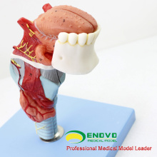THROAT02 (12506) Modèle Larynx avec Toungue et Dents, Agrandir l&#39;image, 5 Pièces, Modèles ORL&gt; Modèles Larynx